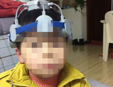 多动症家庭版颅磁仪费用是多少