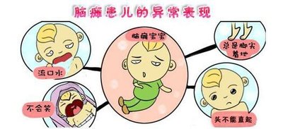 小儿脑瘫用经颅磁刺激仪能治好吗