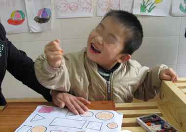 脑性瘫痪有哪些方面的表现