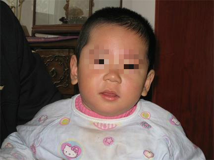 儿童生长发育迟缓用经颅磁能治吗