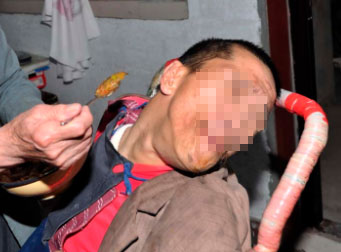 如何对脑瘫患儿进行爬行训练