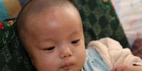 小儿脑瘫的日常护理要做好哪些