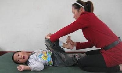 小儿脑瘫有哪些表现